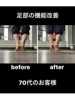 ドリップ 辻井店(DRiP)/ふくらはぎ細く|むくみ改善実績