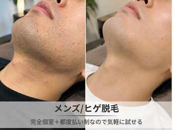 フルーブラン(Frubran)/はじめてのヒゲ脱毛体験