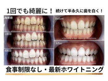 ハピネス 大阪梅田店(Happiness)