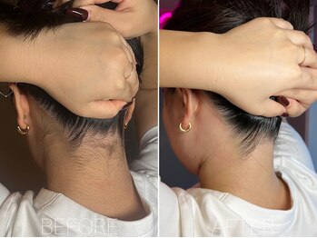 エヴァワックス 恵比寿店(Eva Wax)/【うなじ脱毛】まとめ髪をする方