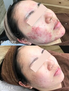 ビアンカ/お客様のお声