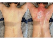 ボニータ(BONITA)の雰囲気(肩こりでお悩みの方♪浮き輪肉でお悩みの方♪★セルクラで改善★)