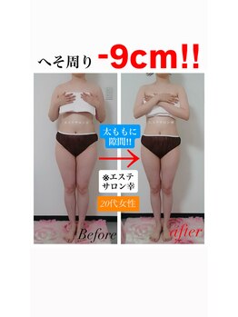 エステサロン 幸/20代 へそ周り -9cm