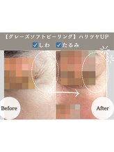 アンジュ(ANGE)&nbsp;人気MENU 