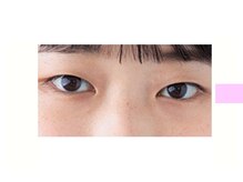 クロム アイプラス 狭山 入曽店(CHROM eye+)/腫れぼったく眠たげなまぶたに！