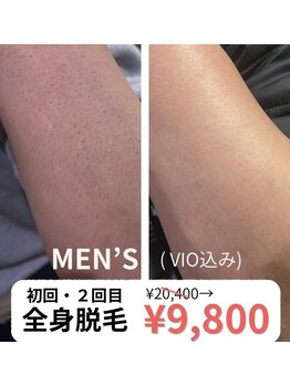 ブライト(Bright)の写真/男性全身(顔or VIO)20,900円→9,800円2回同価格で納得してから始めるられる◎清潔感UPカミソリからの解放