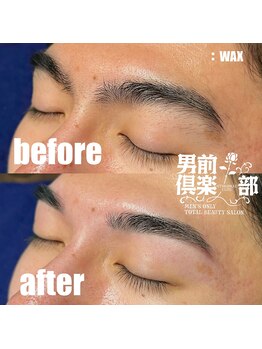 男前倶楽部/脱毛/メンズ脱毛/メンズ専門店