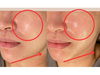 モーイエンチャーム(mooi en charme)の写真/たるみ・くすみ悩みにサヨナラ☆50代からの首肩コリの緩和＆全顔引上げで若々しさUP！！
