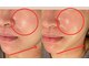 モーイエンチャーム(mooi en charme)の写真/たるみ・くすみ悩みにサヨナラ☆50代からの首肩コリの緩和＆全顔引上げで若々しさUP！！