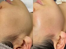 ワンムートブロウ(1mut Brow)の雰囲気（フェイスワックスで艶肌☆イドロジェリーマスクで鎮静・保湿◎）