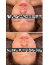 ルヴィショップ 京都駅前店(REVI SHOP)/