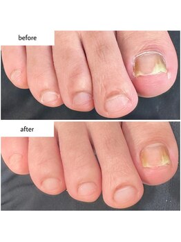 ケアプラス(care plus)/フットネイルケア