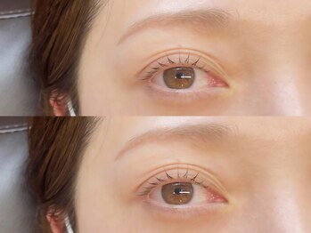 ビュー(V.I.E.W)/LASHLIFT