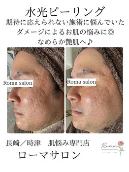 ローマサロン/ダメージによるお肌悩みにも◎
