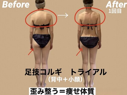 レアフィート(Rheafeet)の写真