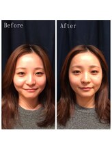 たくろう鍼灸院 豊田本院/Before&After