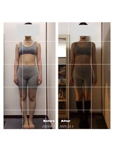 サロン ナウ オア ネバー(Salon Now or Never)/細い方もむくみ取れ健康的に締め