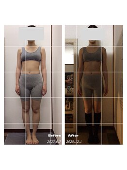 サロン ナウ オア ネバー(Salon Now or Never)/細い方もむくみ取れ健康的に締め