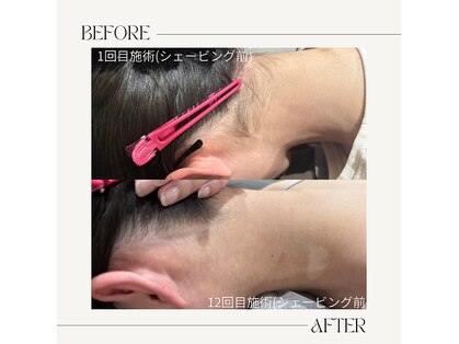 モア トゥインクル 倉敷店(MORE twinkle)の写真