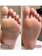 レア(rea)の写真/【角質ケアでガサガサ踵もフワフワに◎】プロの丁寧な施術で、まるで赤ちゃん肌のような感動の触り心地♪

