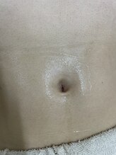 ナノハナ/鹿沼市の全身脱毛のナノハナ