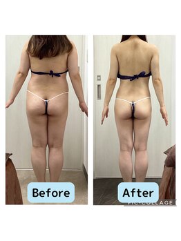 リオンズ 千葉アリオ柏店/体脂肪率が半分に!【痩身】