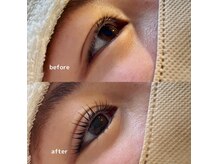 パッチ(PATCH)の雰囲気（お客様に合ったデザインをご提案致します＊）