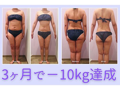 ナレル(narrel)の写真