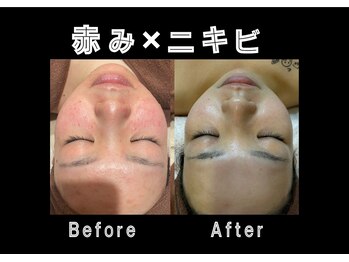 エステティック レイビス 銀座店(RAYVIS)/