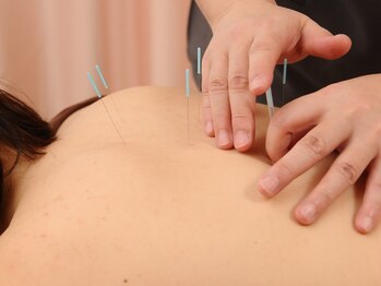 ふわりはり灸整体院/身体の不調もお任せください