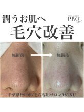 ムク(MUKU)/潤うお肌へ