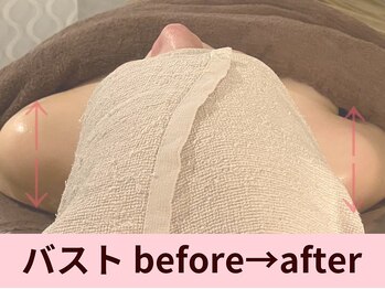 クイーンズチャーム(Queen's Charm)/バストケア★デコルテケア