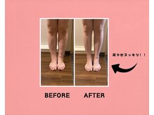 せせらぎ 三重/足のむくみスッキリ！☆