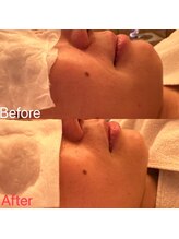 凪 横浜/お肌ふっくら