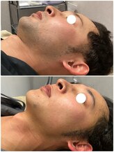 プリマプリート 大垣店/メンズ・ヒゲ脱毛