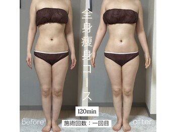 エヌボーテ(N. beaute)/全身痩身コース#4回目