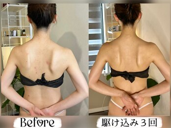 ソウ バイ ソウ(So by 蒼)/駆け込み3回・圧倒的な結果!