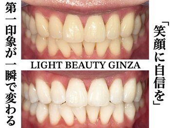 ライトビューティー 銀座店(LightBeauty)