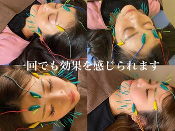 恵比寿駅前整骨院はり院 別館