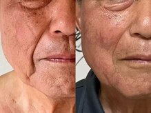 健康美 東洋医学療法院 鴻巣店/美らくる吸引療法