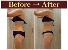 クオレ(CUORE)/ビフォーアフター