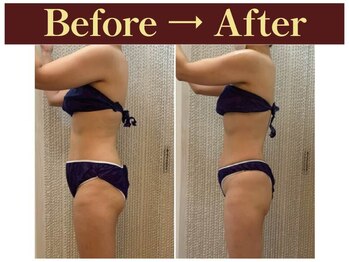 クオレ(CUORE)/ビフォーアフター