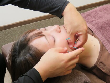 たく鍼灸整骨院の写真