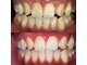 ホワイトニングビューティー 光の森店(WHITENING BEAUTY)の写真