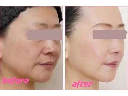 フイ(Hui)の写真