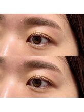 シック(Chic)/ラッシュリフト