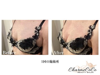 シャルムココ 蔵前店(CharmeCoCo)/お客様Before→After