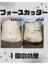 めいてる/ダイエット/ぽっこりお腹/大阪市