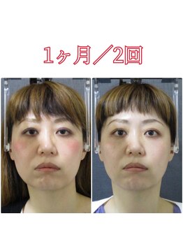 顔と身体の歪み矯正院 吉祥寺/ビフォーアフター