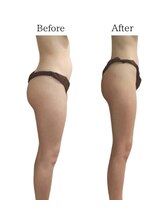 リカバリー(&recovery)/中半身のモタつきrecovery